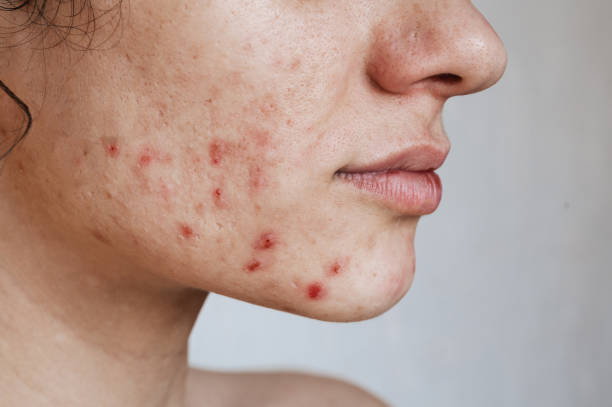 istockphoto-1493956084-612x612.jpg
